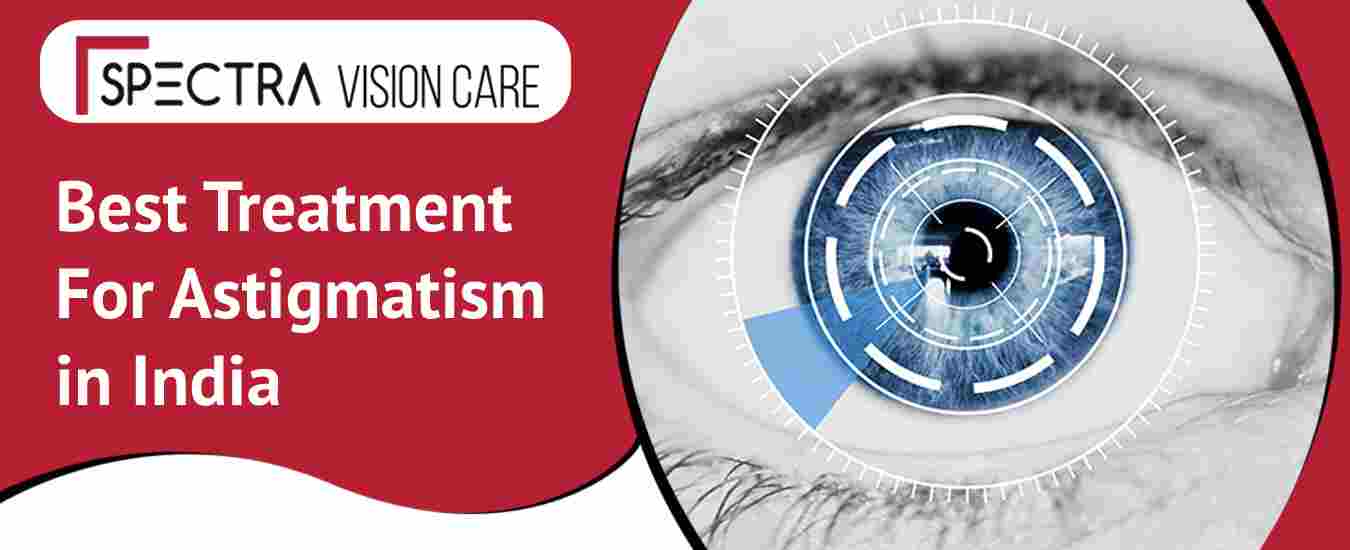 Best Treatment for Astigmatism in India